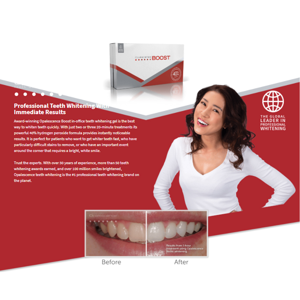 Opalescence Boost 40% PF Ameri - Teeth Whitening Gel Opalescence avaliação e preço