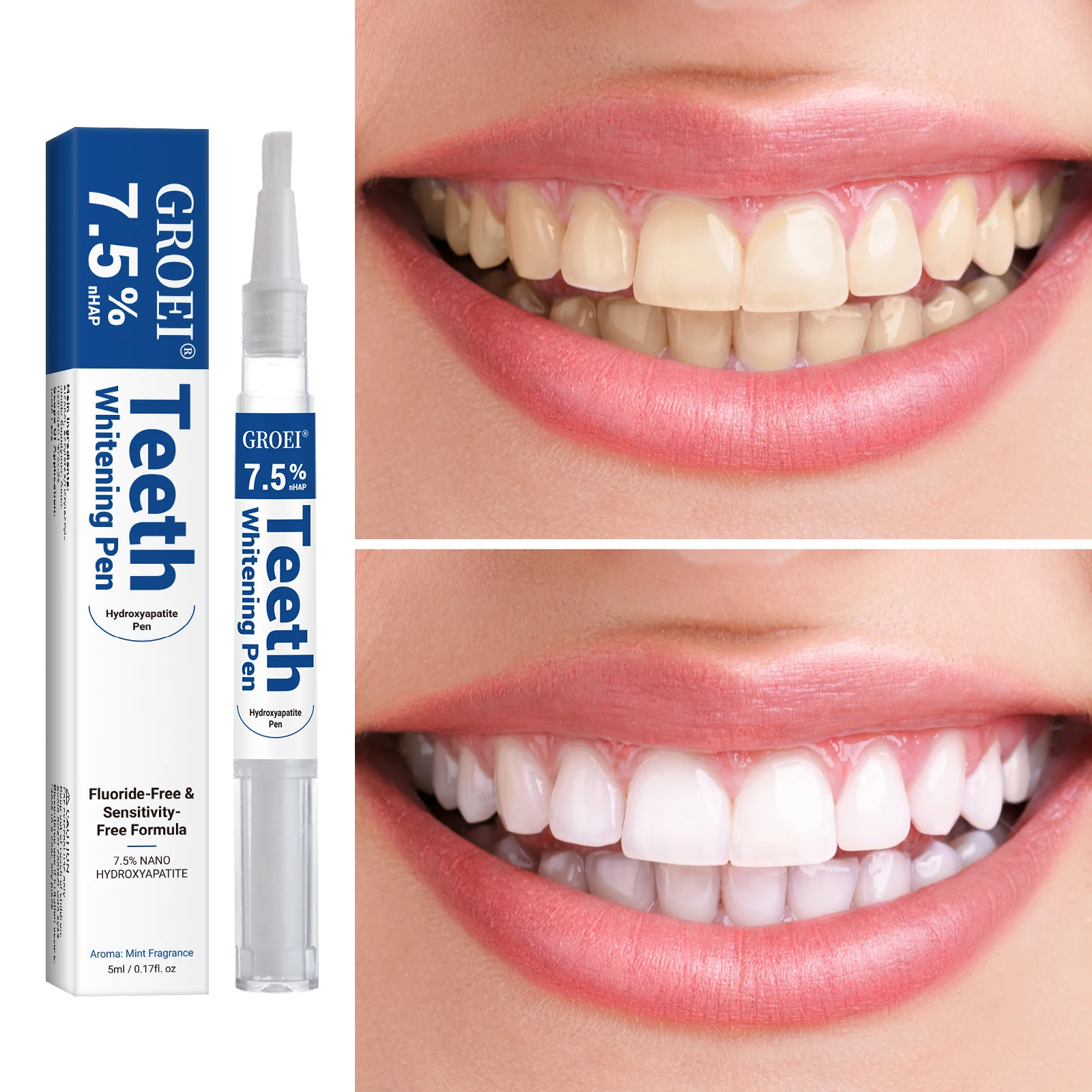 Caneta branqueadora de dente h - Teeth Whitening Remedies avaliação e preço