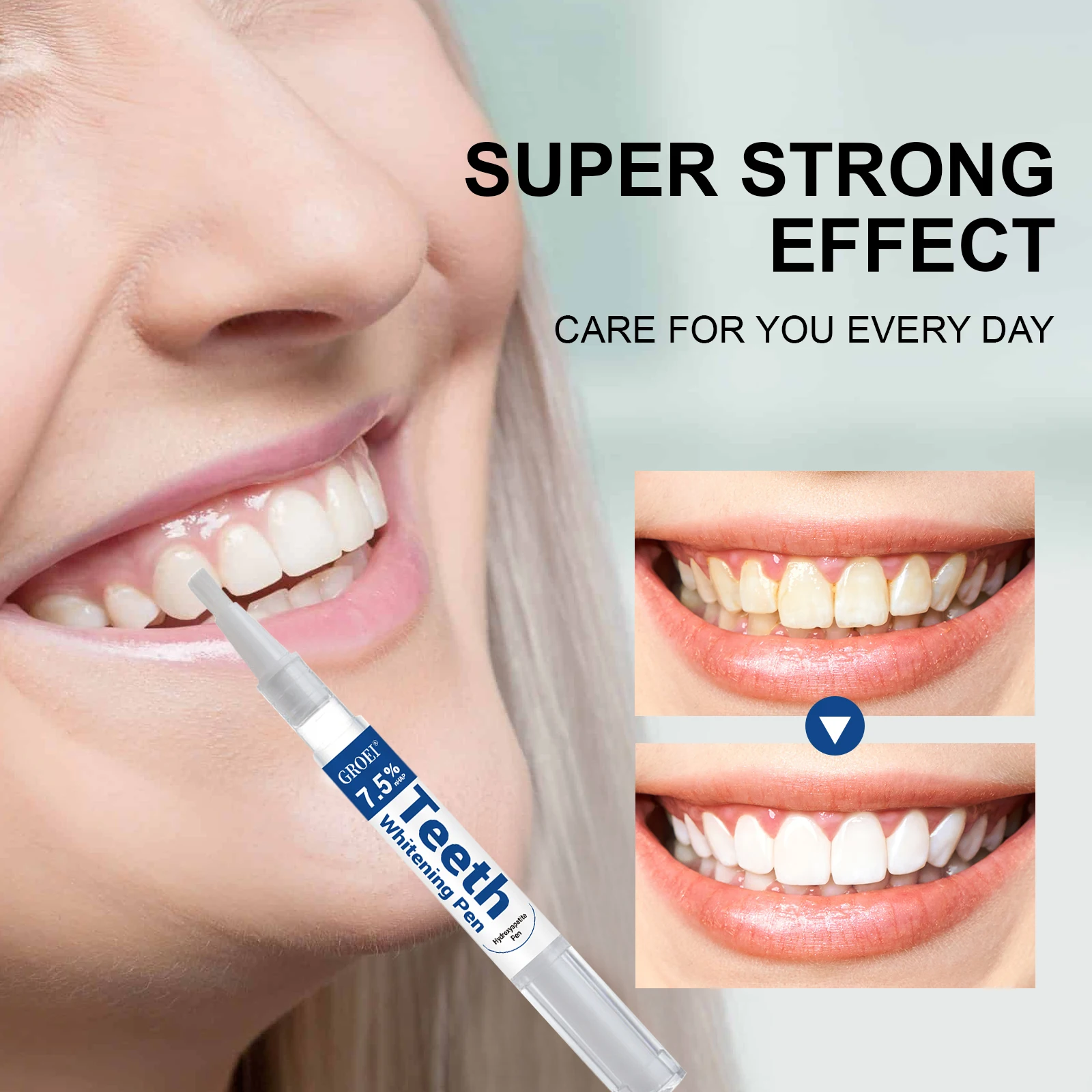 Caneta branqueadora de dente h - Teeth Whitening Remedies avaliação e preço