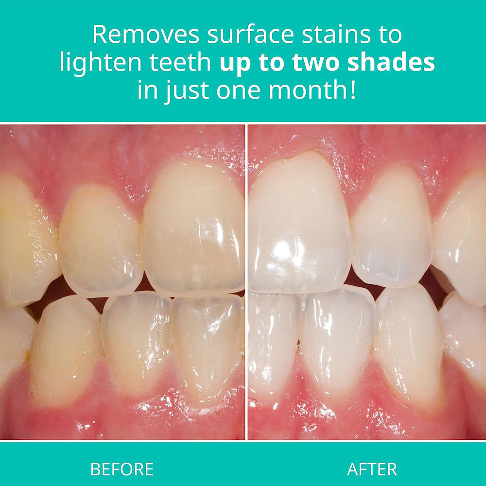 Opalescence Whitening Toothpas - Teeth Whitening Gel Opalescence avaliação e preço