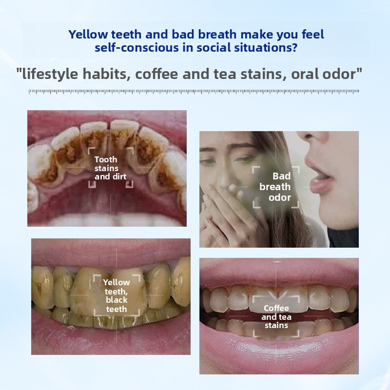 Pó Dental Clareador e Branquea - Teeth Whitening Enzymes avaliação e preço