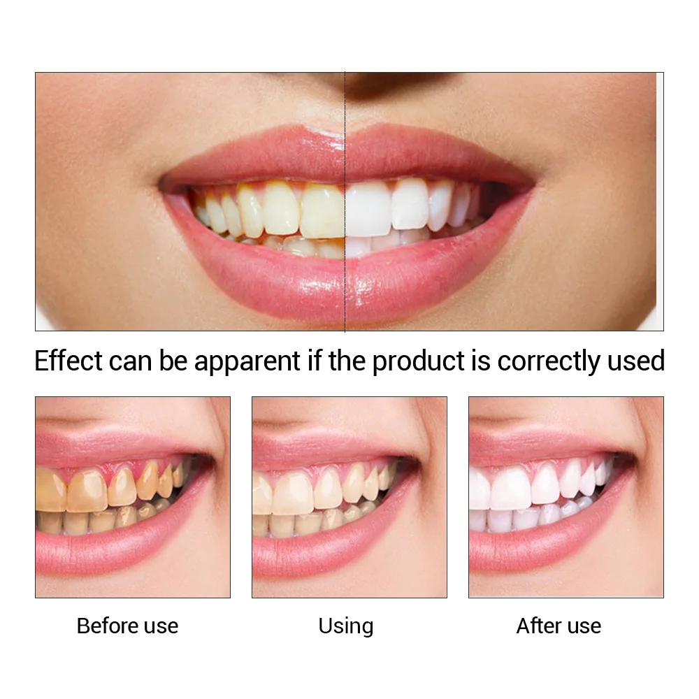 FTEENPLY Essência para claream - Teeth Whitening Zimba avaliação e preço