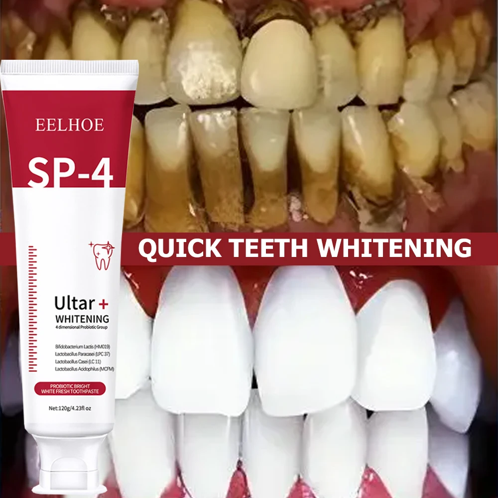 Creme dental clareador probiót - Teeth Whitening Enzymes avaliação e preço